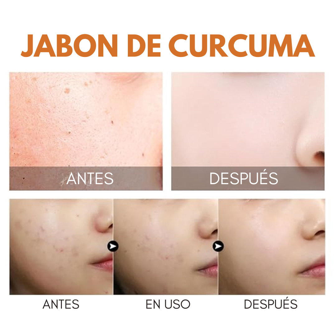JABÓN DE CÚRCUMA – Limpieza profunda, piel uniforme y libre de imperfecciones