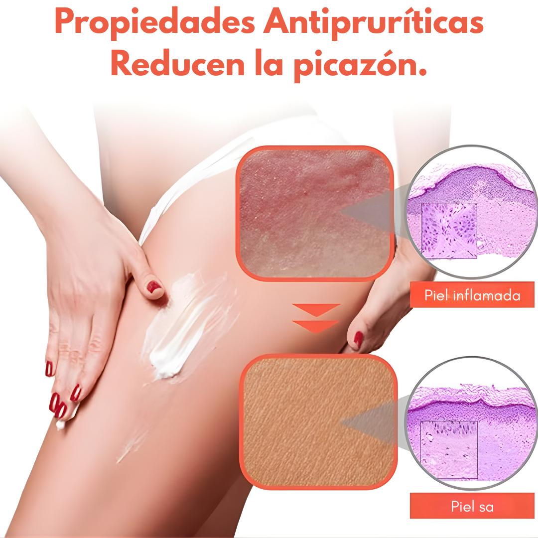 CREMA ANTIPICAZÓN – Alivio instantáneo para tu piel