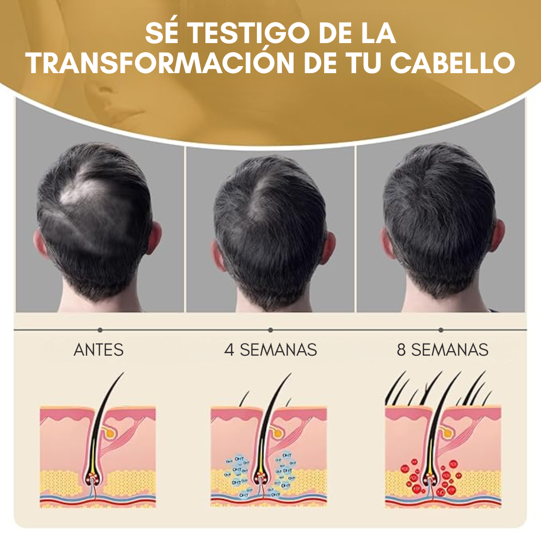 SUERO CAPILAR MONOXIDIL 5% – Reactiva el crecimiento y fortalece el cabello masculino