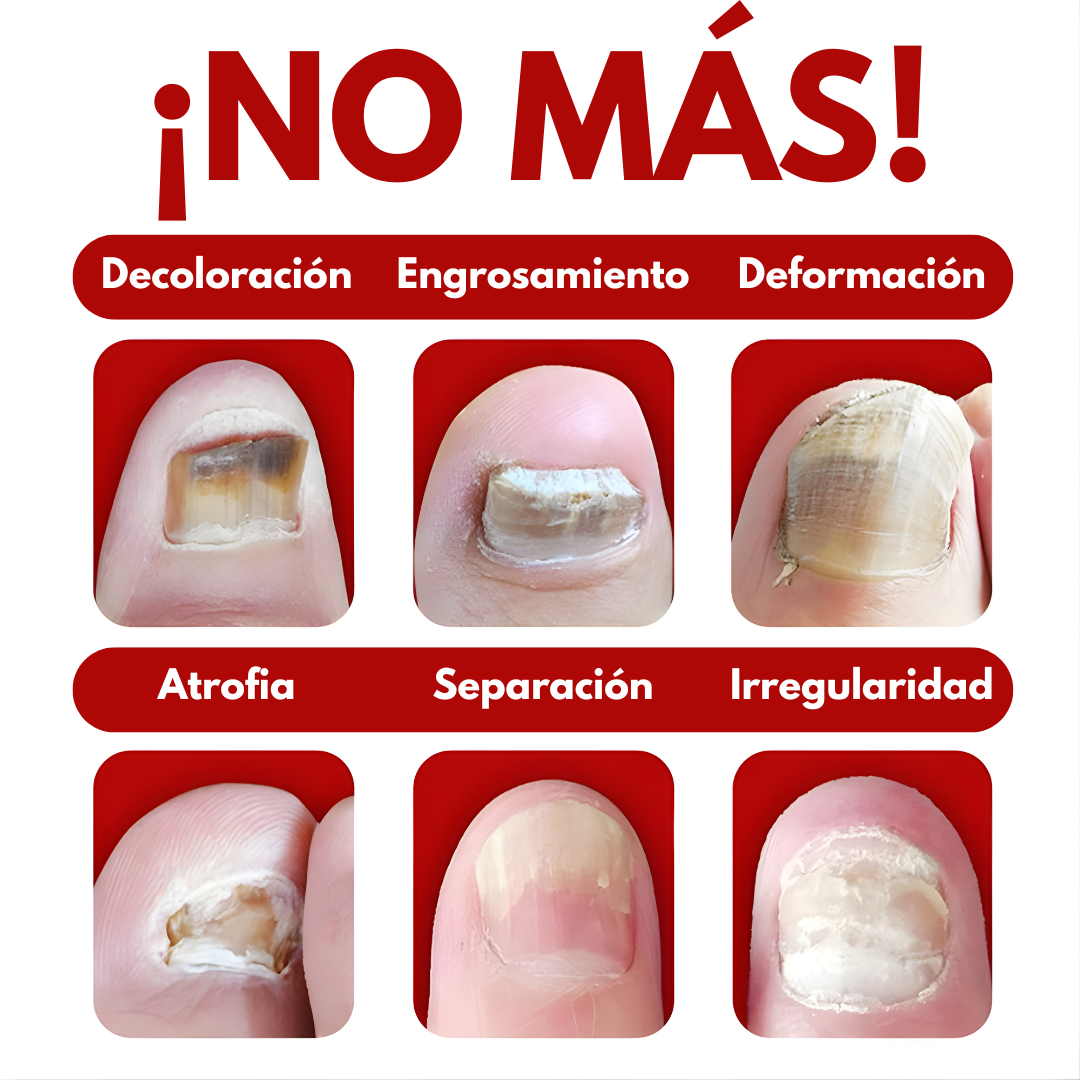7 DÍAS DE TRATAMIENTO PARA LAS UÑAS — Cuidado intensivo para uñas más limpias y fuertes