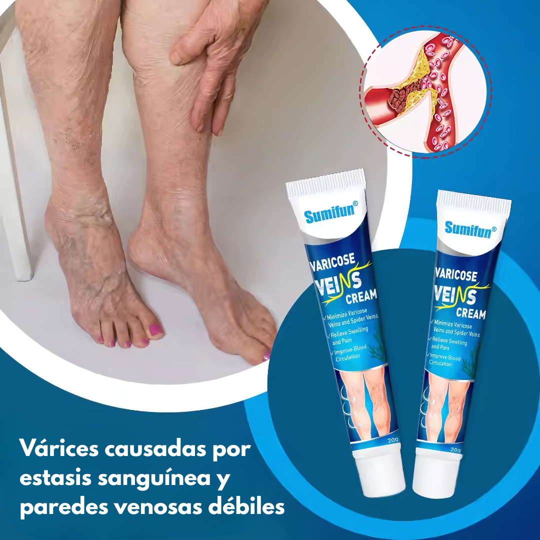 CREMA PARA VÁRICES – Alivio visible para piernas cansadas y venas marcadas