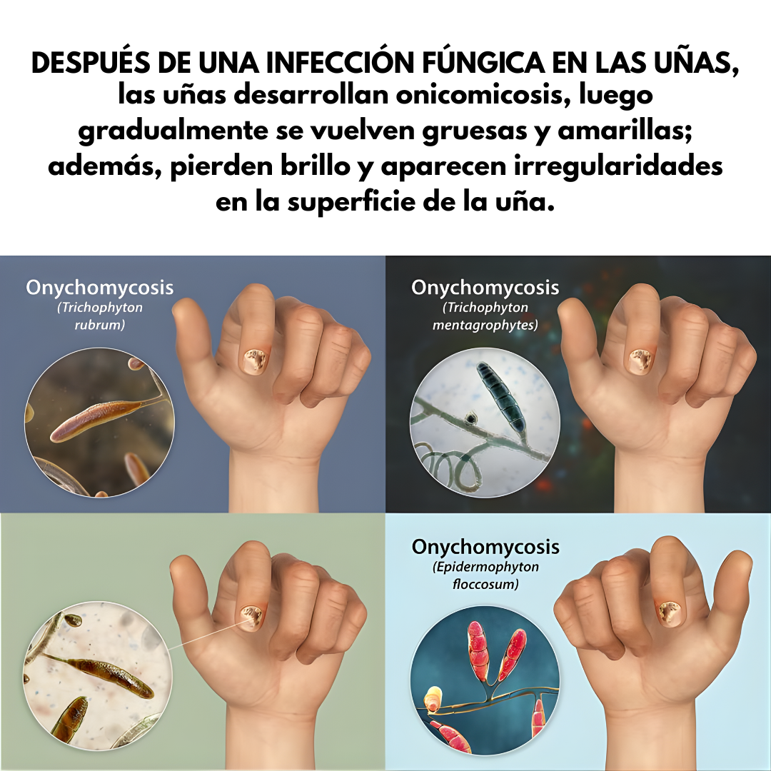 7 DÍAS DE TRATAMIENTO PARA LAS UÑAS — Cuidado intensivo para uñas más limpias y fuertes