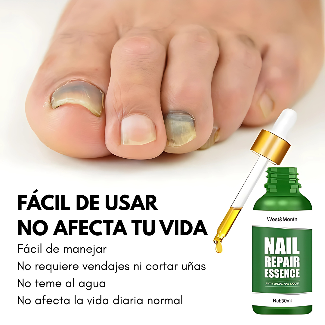 ESENCIA REPARADOR DE UÑAS NAIL – Fortalece y nutre tus uñas dañadas