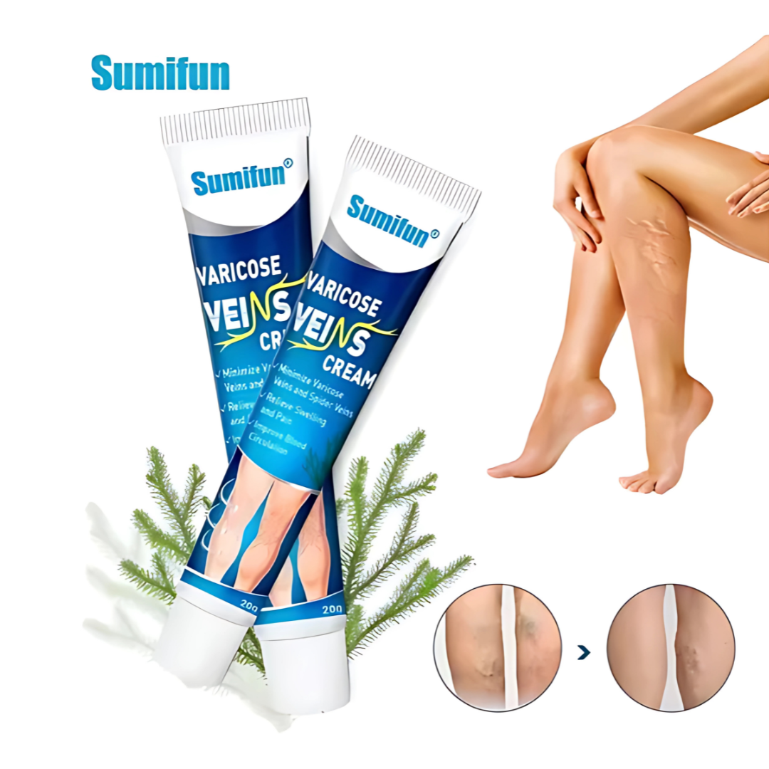 CREMA PARA VÁRICES – Alivio visible para piernas cansadas y venas marcadas