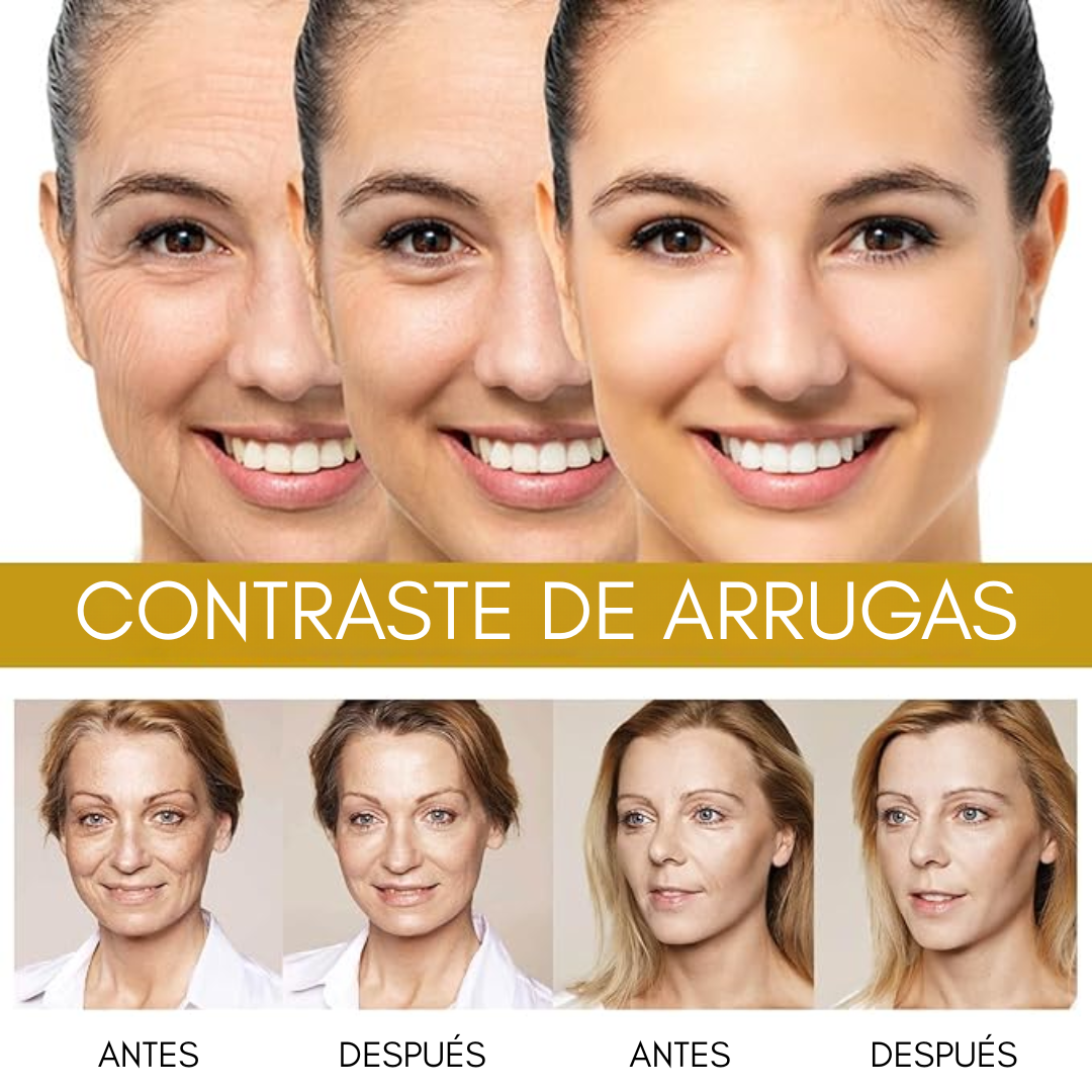 SUERO RESTAURADOR DE ABEJA – Regenera, reafirma y rejuvenece tu piel naturalmente