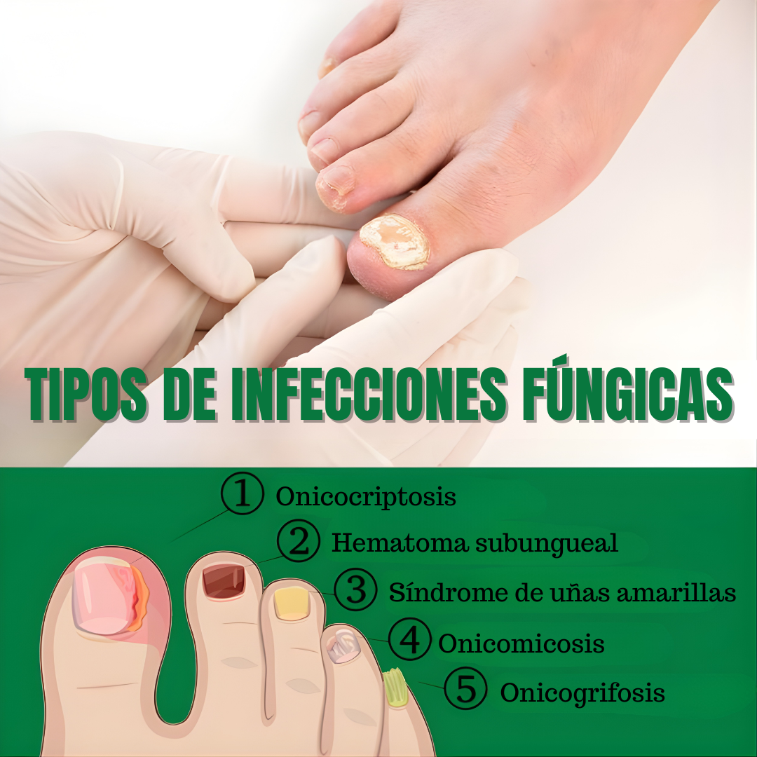 7 DÍAS DE TRATAMIENTO PARA LAS UÑAS — Cuidado intensivo para uñas más limpias y fuertes