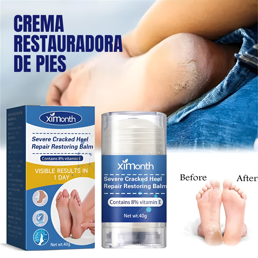 CREMA RESTAURADORA DE PIES – Talones suaves, piel renovada