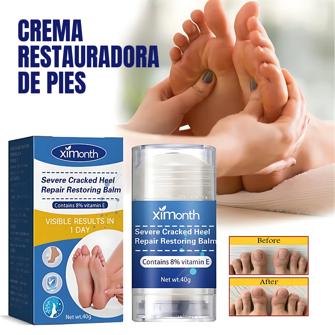 CREMA RESTAURADORA DE PIES – Talones suaves, piel renovada