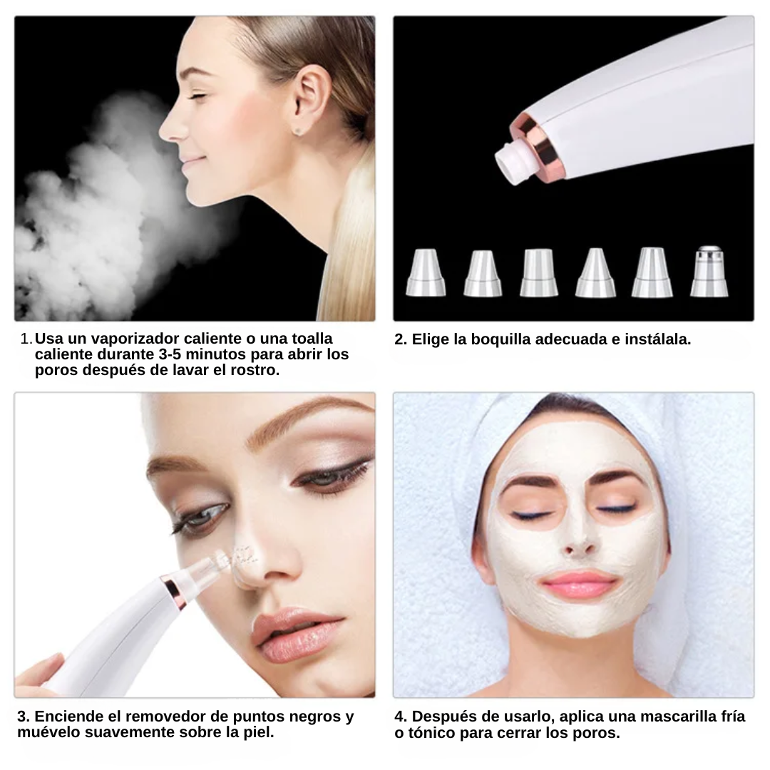 DermaSuction Max – Limpieza Facial Profesional