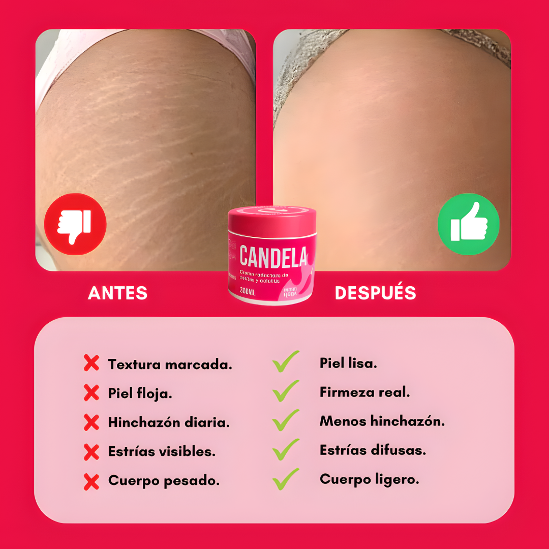 CANDELA CREAM – Firmeza visible, piel renovada y cuidado profundo desde la primera aplicación