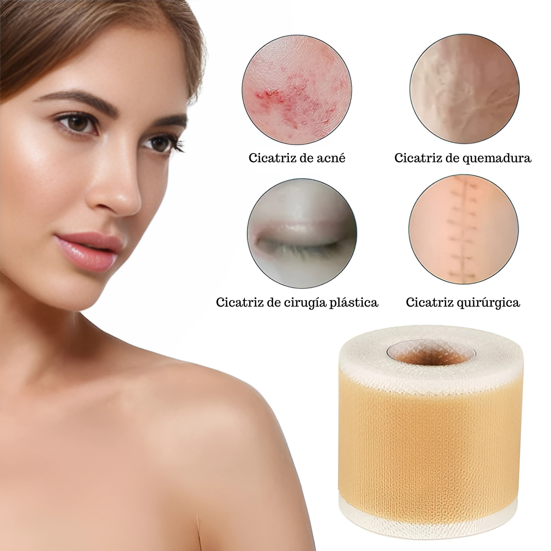 CINTA DE SILICONA PARA ELIMINAR CICATRICES – Tratamiento efectivo para cicatrices nuevas o antiguas