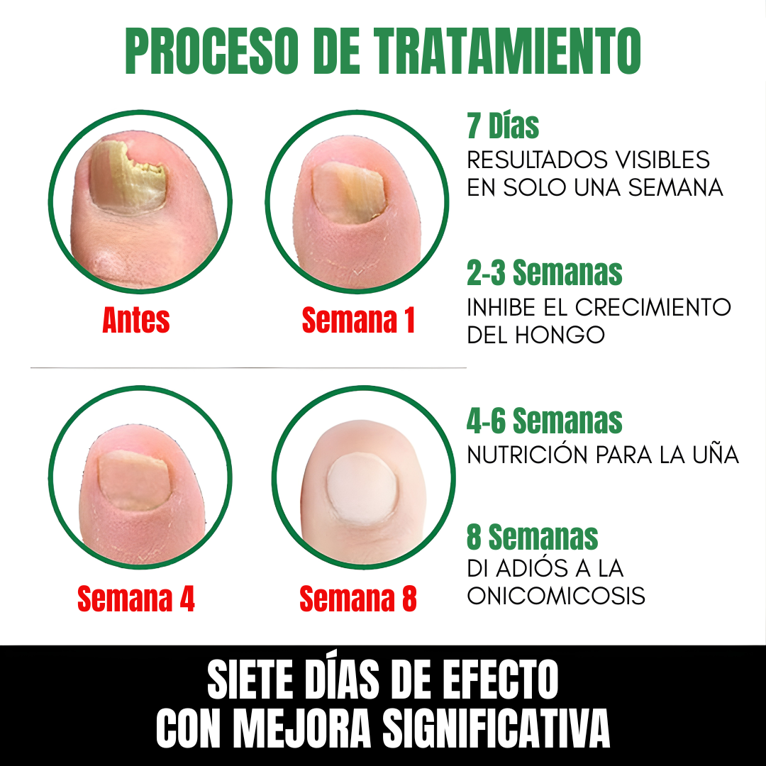 7 DÍAS DE TRATAMIENTO PARA LAS UÑAS — Cuidado intensivo para uñas más limpias y fuertes