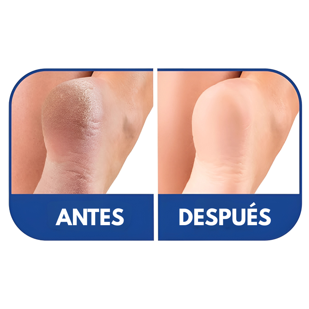 EXFOLIANTE PARA PIES – Talones suaves, renovados y sin durezas en minutos