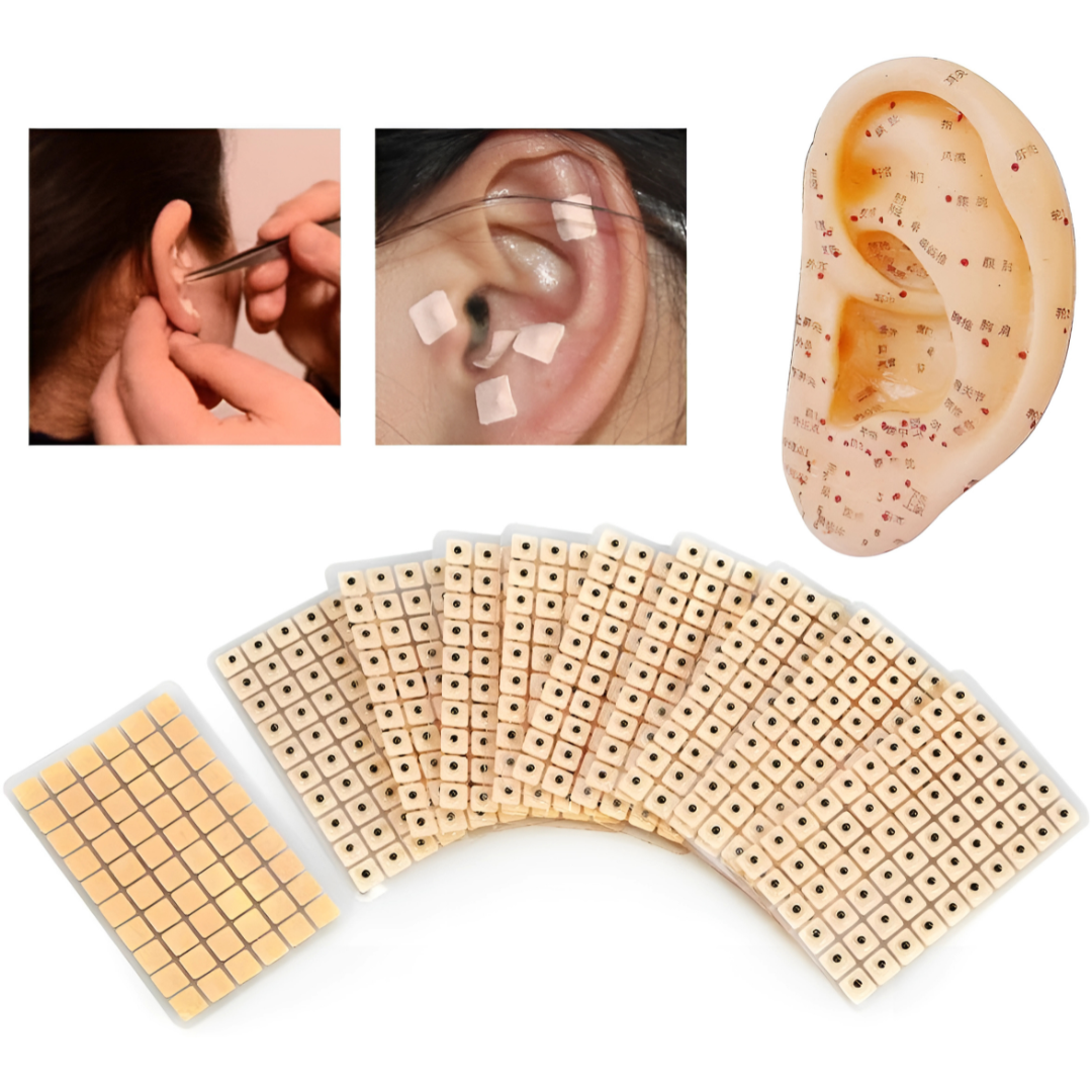 BALINES MAGNÉTICOS PARA ACUPUNTURA (240 PARCHES) – Alivio natural con estimulación auricular sin agujas