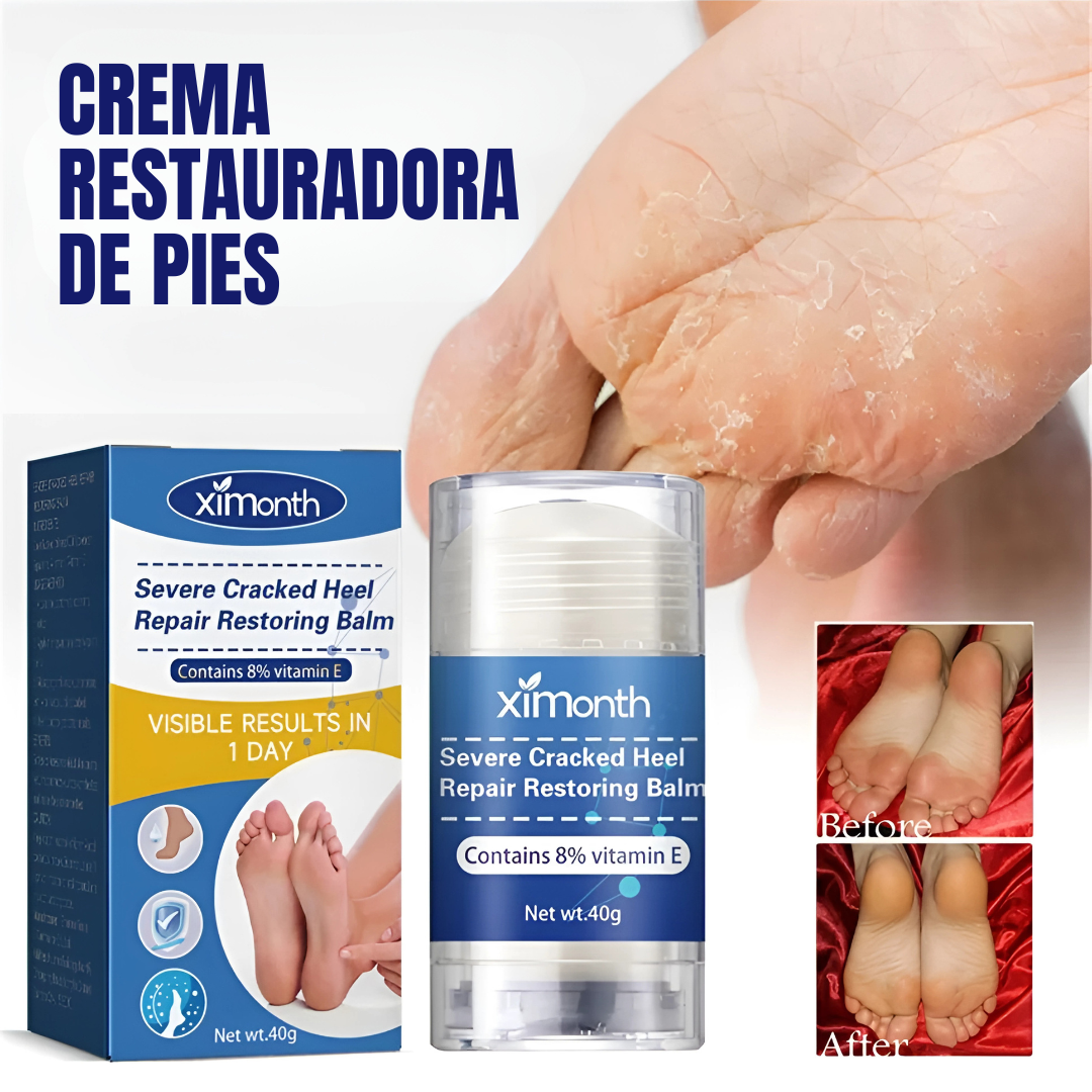 CREMA RESTAURADORA DE PIES – Talones suaves, piel renovada