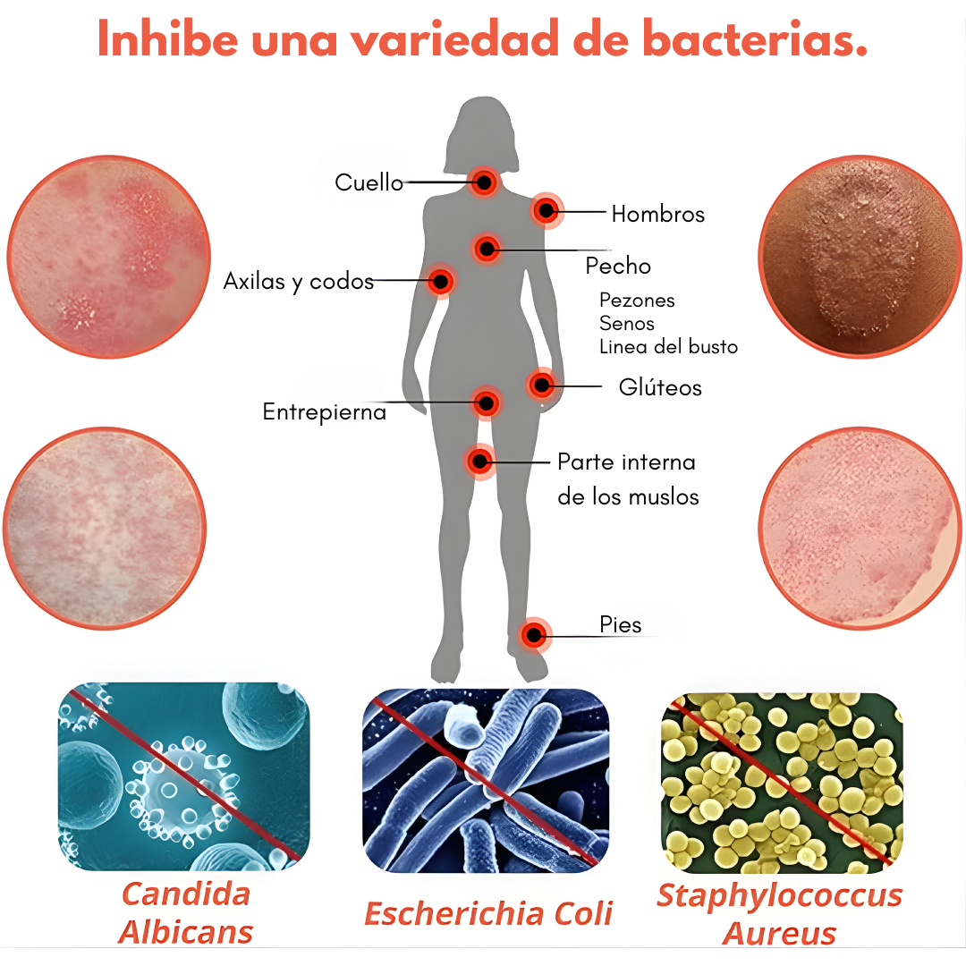 CREMA ANTIPICAZÓN – Alivio instantáneo para tu piel
