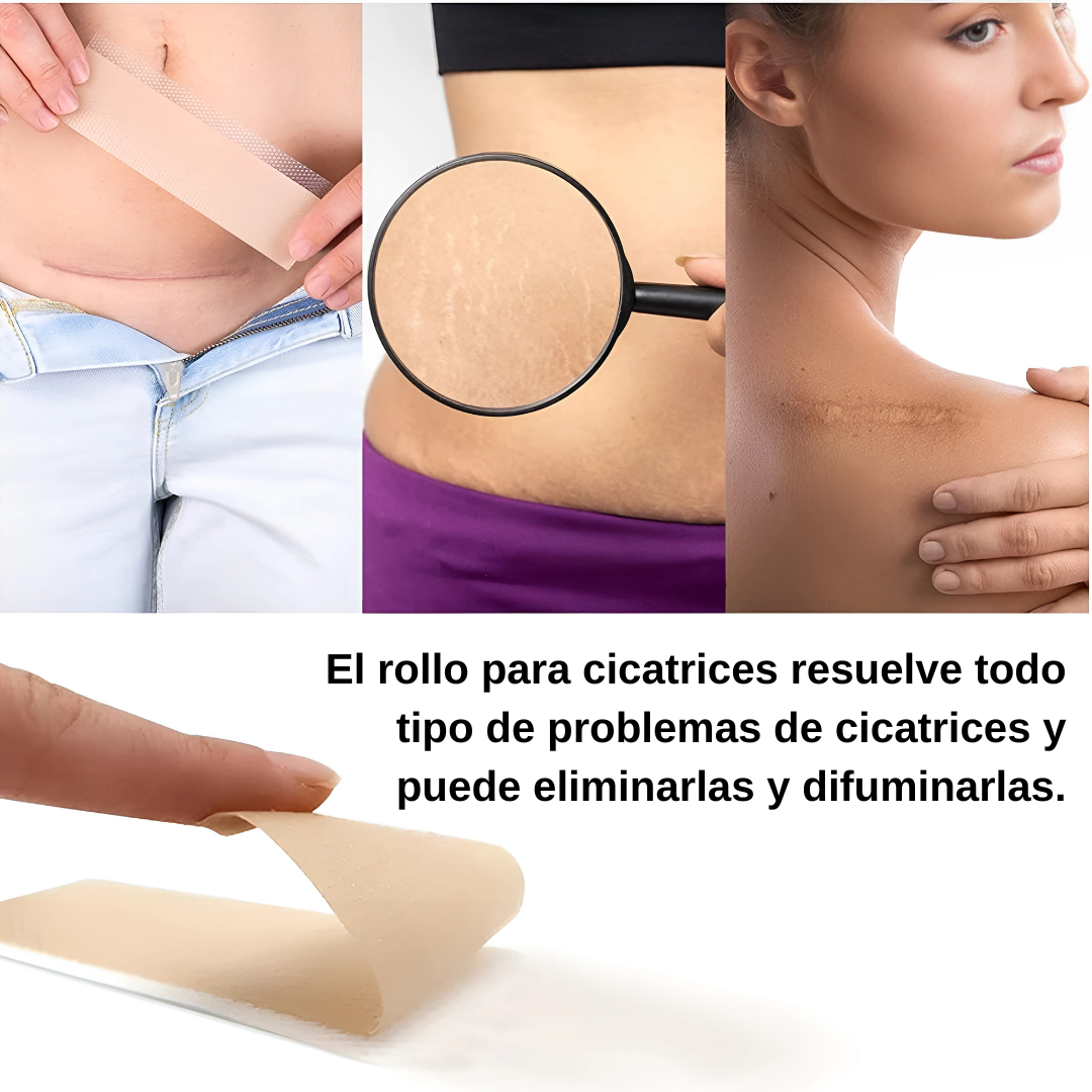 CINTA DE SILICONA PARA ELIMINAR CICATRICES – Tratamiento efectivo para cicatrices nuevas o antiguas