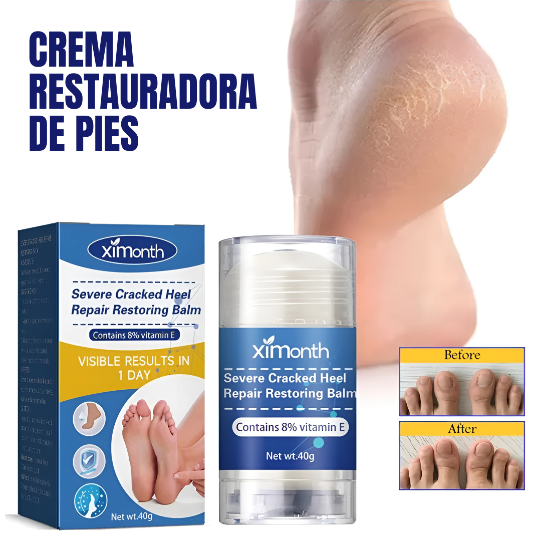 CREMA RESTAURADORA DE PIES – Talones suaves, piel renovada