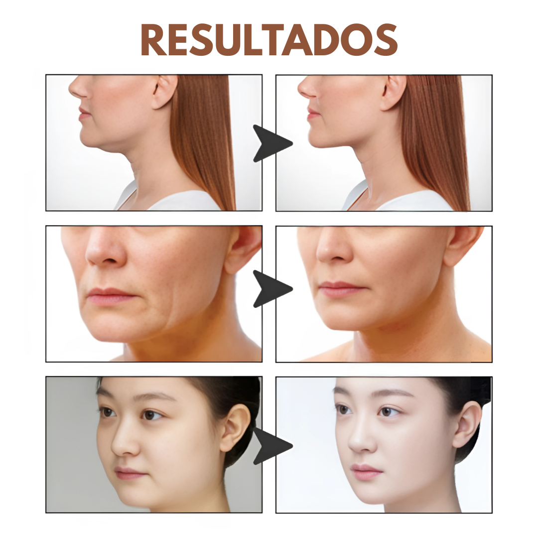 LIFT TAPE FACIAL (PACK X2) – Efecto lifting instantáneo sin cirugía ni dolor