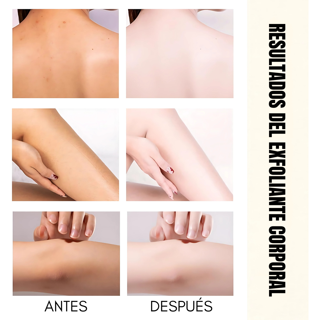 EXFOLIANTE DE ARROZ PARA CUERPO Y ROSTRO – Piel suave, limpia y luminosa naturalmente