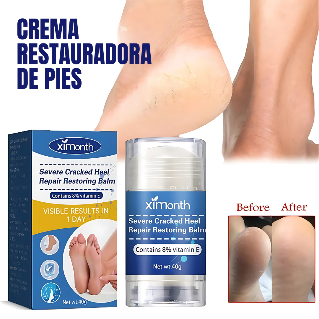 CREMA RESTAURADORA DE PIES – Talones suaves, piel renovada