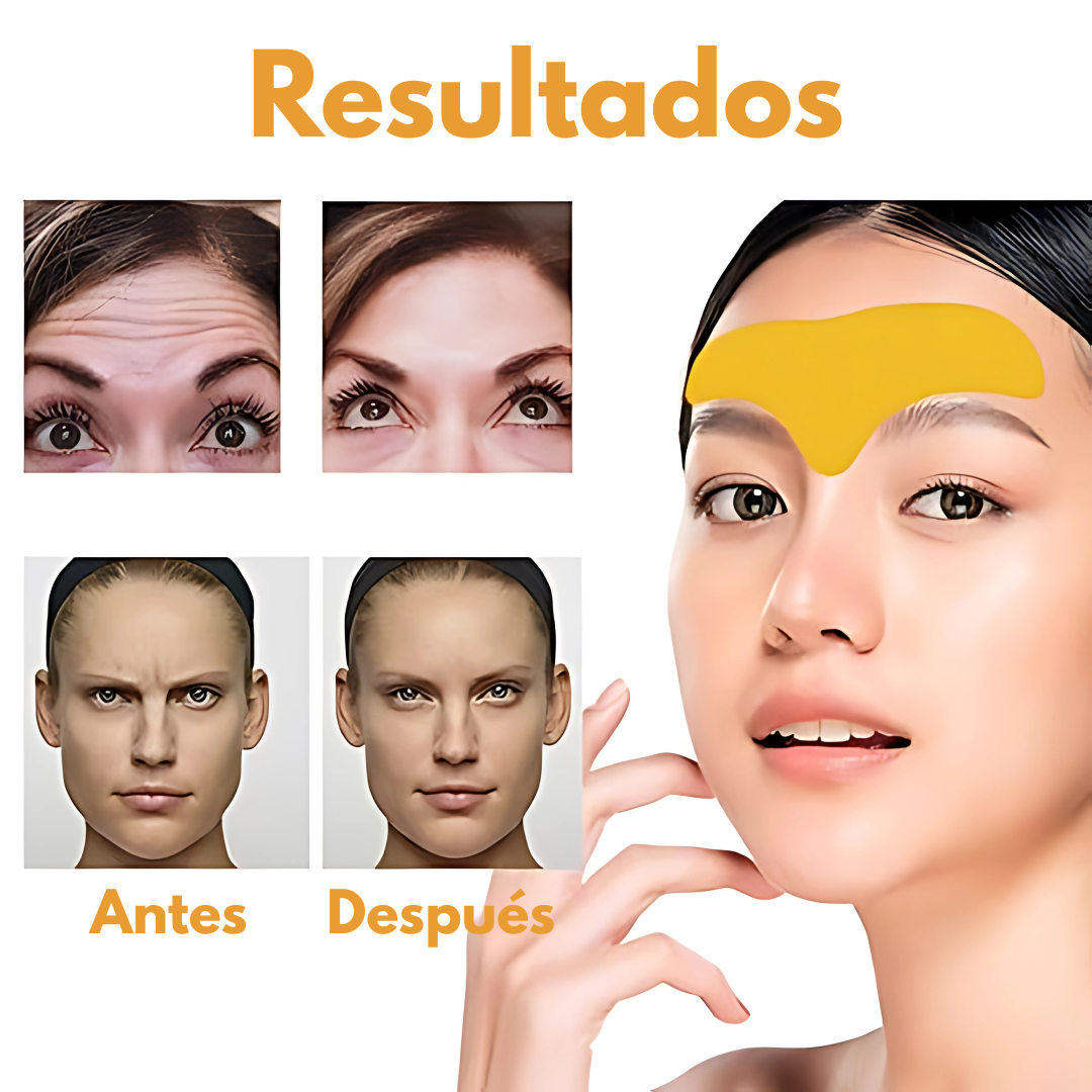 PARCHES PARA LÍNEAS DE EXPRESIÓN (CAJA 10 UNIDADES) – Alisa y rejuvenece tu piel mientras descansas