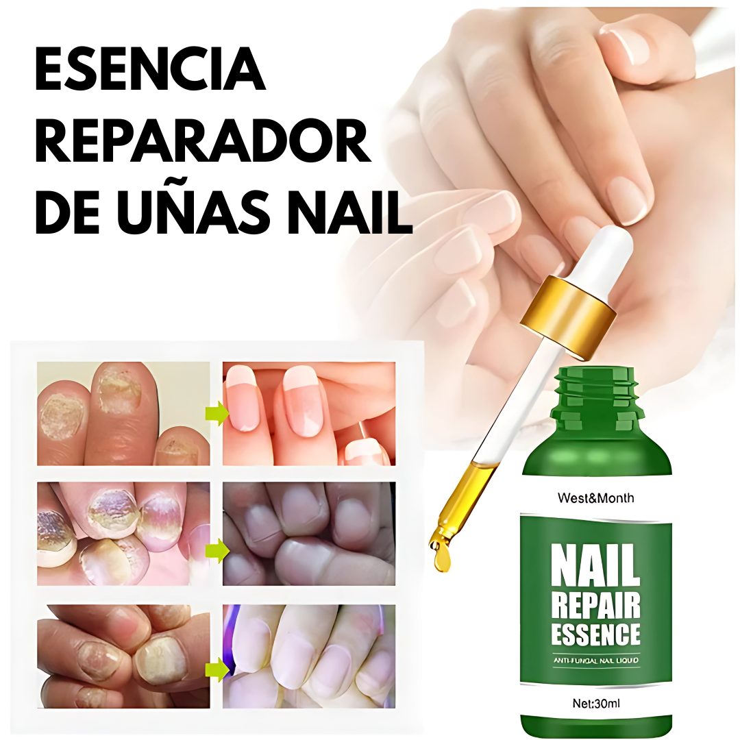 ESENCIA REPARADOR DE UÑAS NAIL – Fortalece y nutre tus uñas dañadas