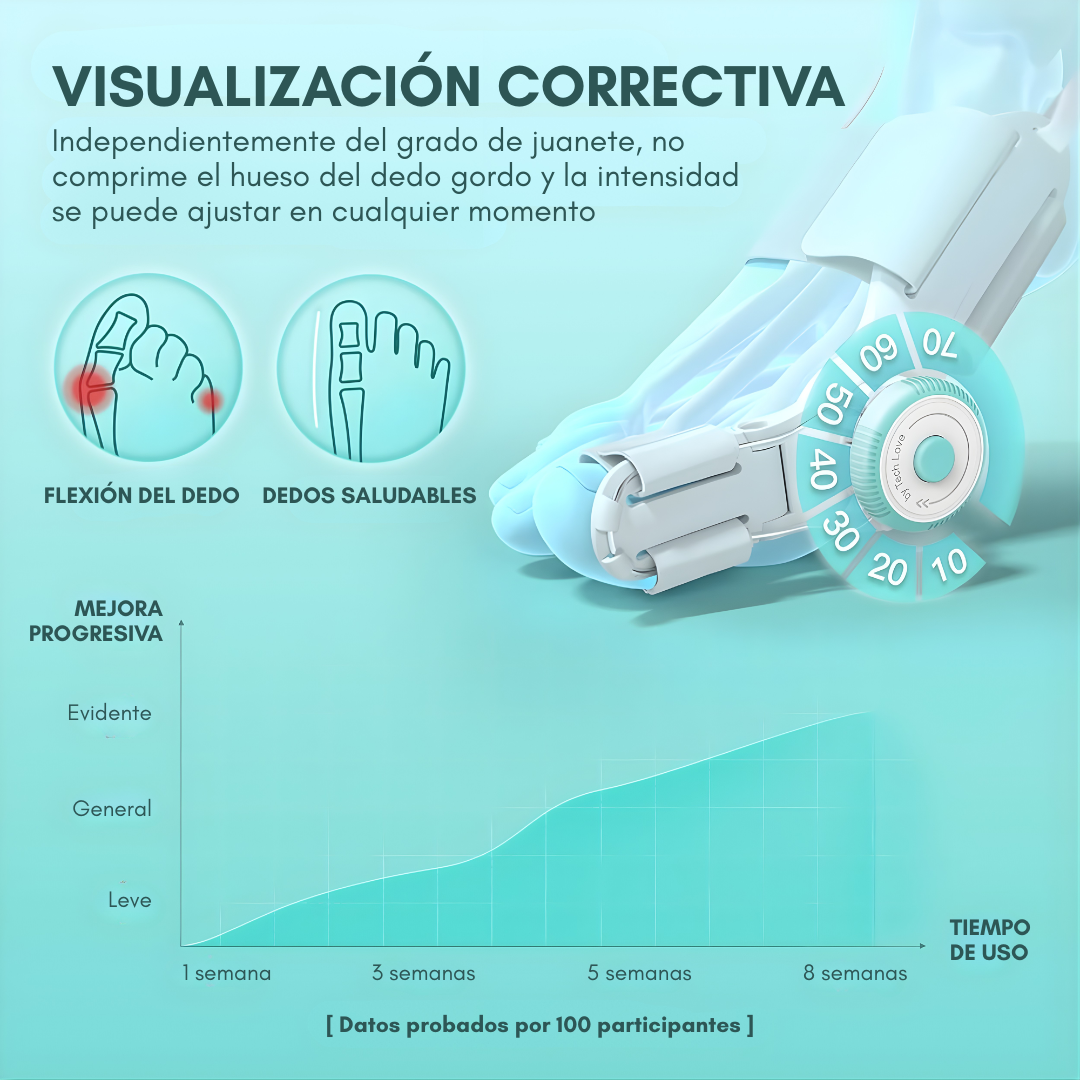 CORRECTOR DE JUANETES – Alineación y alivio para tus pies