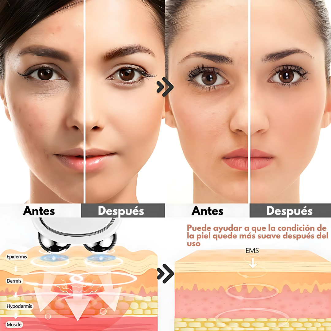 LEVANTAMIENTO LIFTING FACIAL MICROCORRIENTE – Reafirma y rejuvenece tu piel sin salir de casa