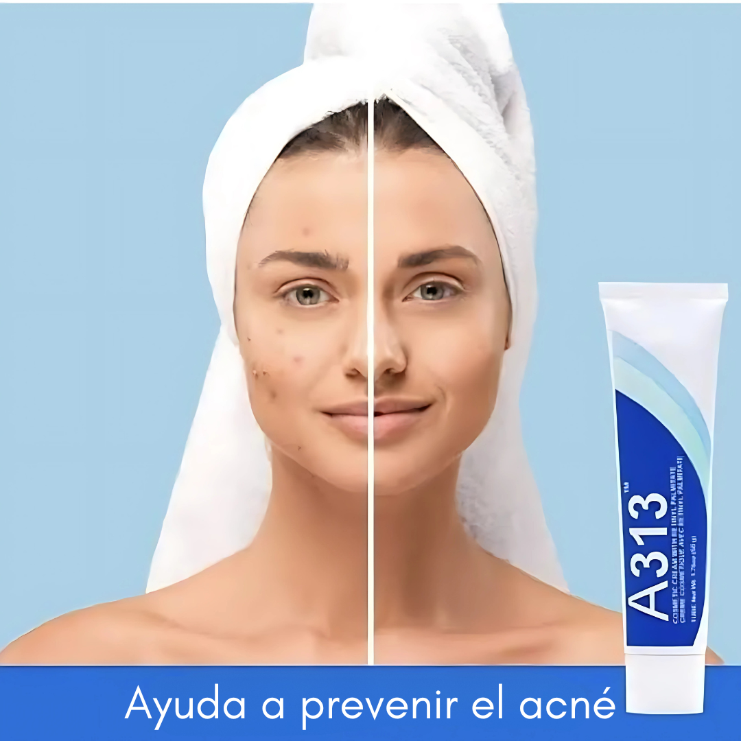 A313 CREMA COSMÉTICA NOCTURNA ANTIARRUGAS – Regeneración y juventud en tu piel