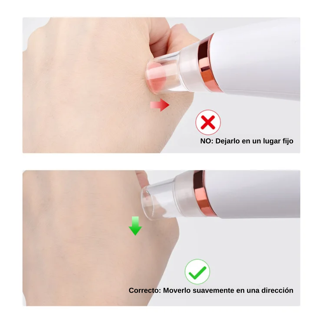DermaSuction Max – Limpieza Facial Profesional
