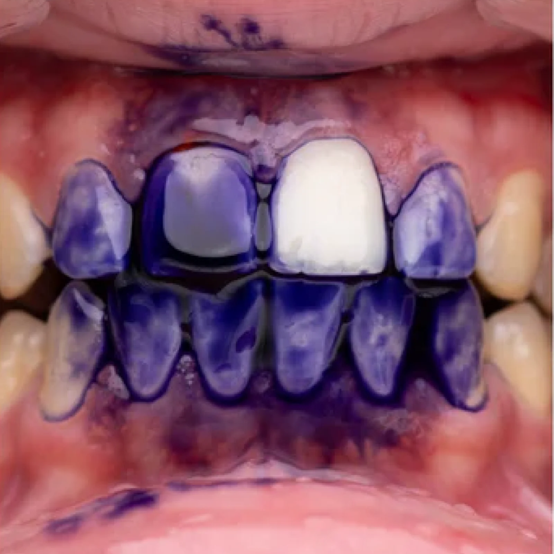 Pasta dental BrightBerry - Di adiós al tono amarillento y luce una sonrisa impecable.